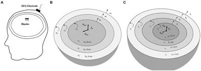 A hybrid boundary element-finite element approach for solving the EEG forward problem in brain modeling